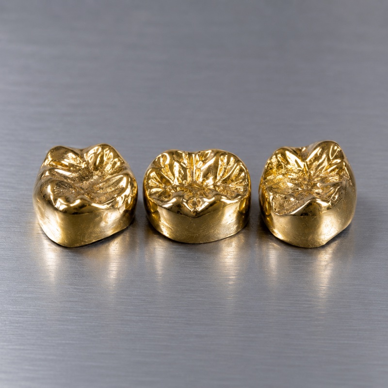 金歯